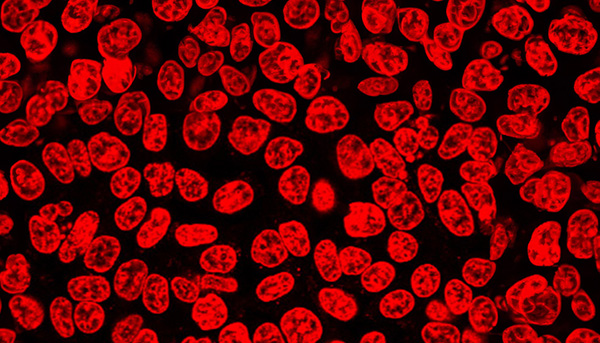 Considerations for Selecting a Fluorescent Dye or Ligand