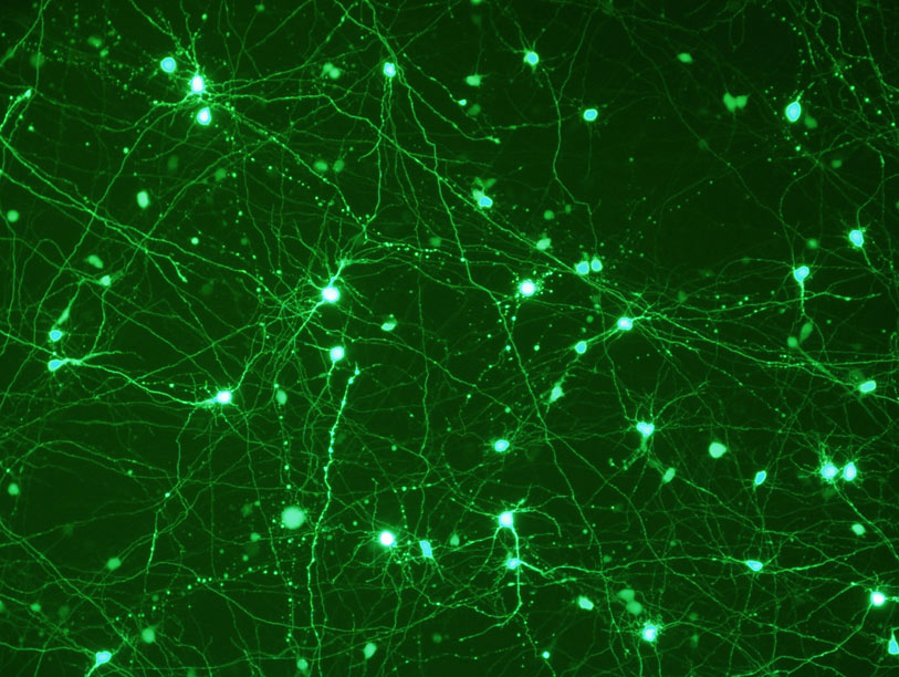 Neurons transfected with Viafect reagent 12644-W