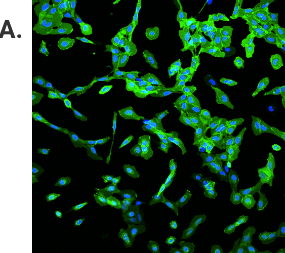 U2OS cells imaged with 488nm laser excitation for Alexa Fluor® 488 Ligand.
