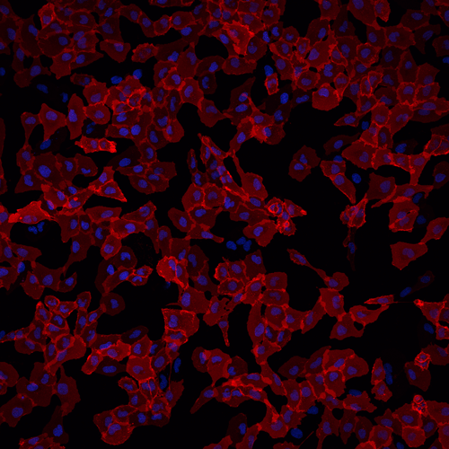 U2OS cells imaged with 561nm laser excitation for Janelia Fluor® 549i Ligand.