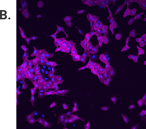 U2OS cells imaged with 640nm laser excitation for Alexa Fluor® 660 Ligand.