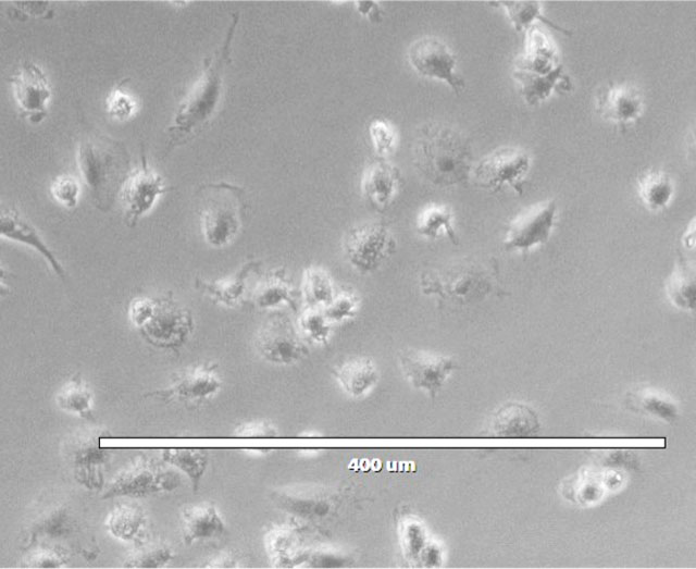 Image of Human Macrophages (ADCP-Qualified).