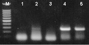 Rapid screening of T-vector cloning recombinants by PCR amplification.