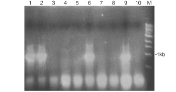 Agarose gel stained with ethidium bromide to detect PCR products generated from S. pombe colonies.