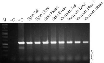 Amplification of genomic DNA purified using the Wizard SV kit.